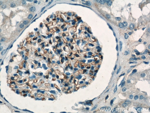 [55383-1-AP-20UL] HLA-A Polyclonal antibody
