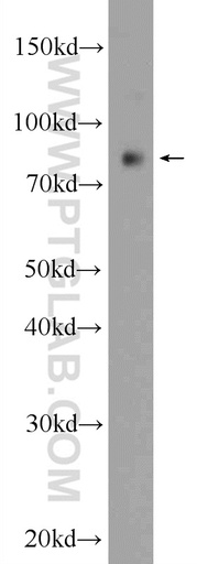 [55386-1-AP-20UL] PPP1R3F Polyclonal antibody