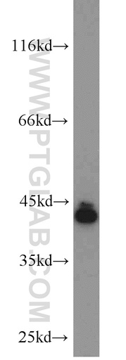 [55390-1-AP-20UL] SCARA5 Polyclonal antibody