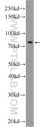 [55394-1-AP-20UL] KLHL9 Polyclonal antibody