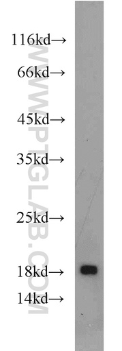[55397-1-AP-20UL] DR3 Polyclonal antibody