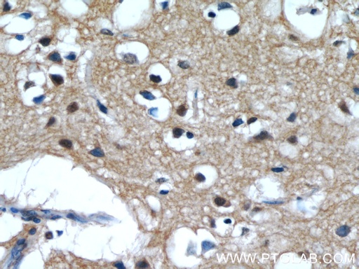 [55398-1-AP-20UL] IMPDH2-specific  Polyclonal antibody