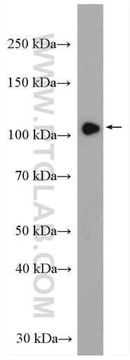 [55408-1-AP-20UL] HIPK2 Polyclonal antibody