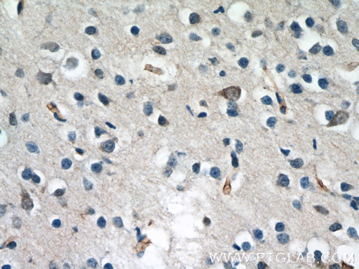 [55410-1-AP-20UL] ND5 Polyclonal antibody