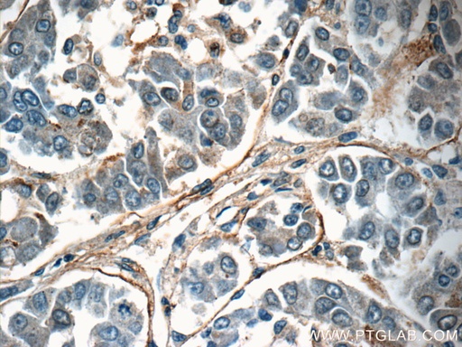 [55411-1-AP-150UL] TMEM181 Polyclonal antibody