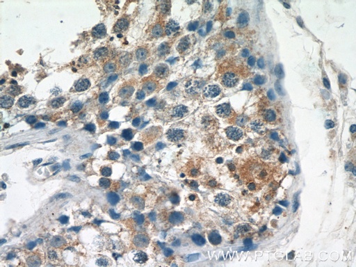 [55426-1-AP-20UL] TSN Polyclonal antibody