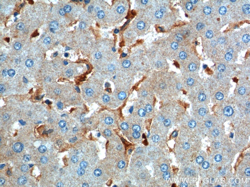 [55427-1-AP-150UL] CD169 Polyclonal antibody