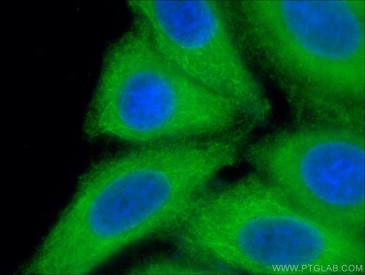 [55428-1-AP-150UL] CYP3A7 Polyclonal antibody
