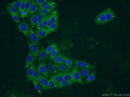 [55429-1-AP-20UL] PYGL Polyclonal antibody