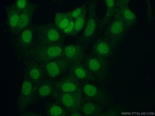[55430-1-AP-20UL] STUB1 Polyclonal antibody