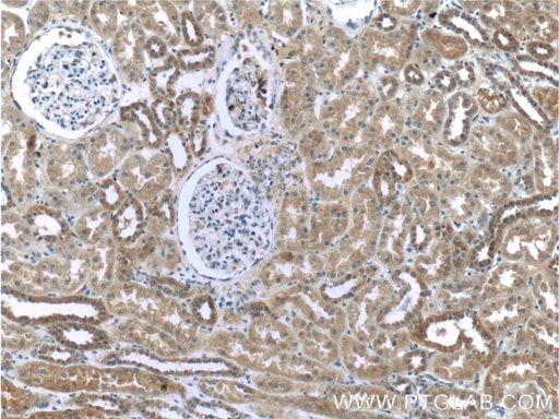 [55432-1-AP-20UL] WTX Polyclonal antibody