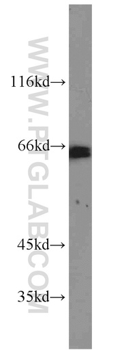 [55435-1-AP-150UL] GATA6 Polyclonal antibody