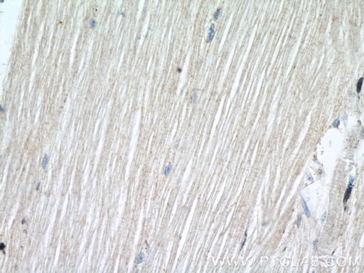 [55438-1-AP-20UL] SCN4B Polyclonal antibody
