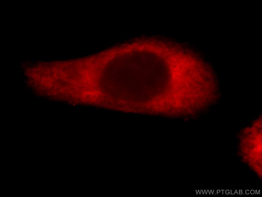 [55439-1-AP-20UL] Loricrin Polyclonal antibody