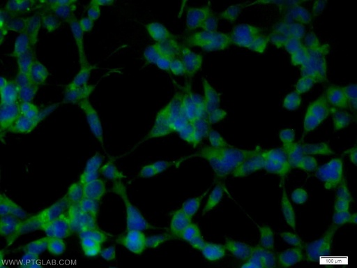 [55440-1-AP-150UL] EXOC6B Polyclonal antibody