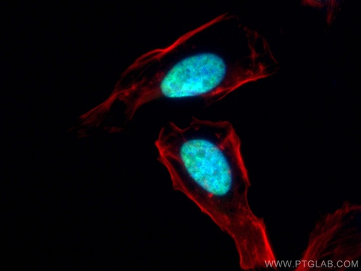 [55441-1-AP-150UL] ESR2 Beta 3 Polyclonal antibody