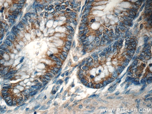 [55444-1-AP-150UL] TPM3 Polyclonal antibody