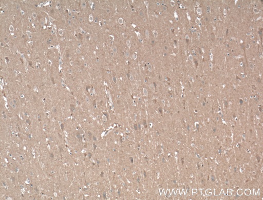 [55447-1-AP-20UL] AHSA2 Polyclonal antibody