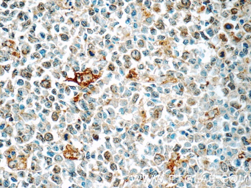 [55451-1-AP-150UL] CLEC9A Polyclonal antibody