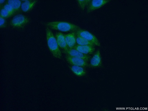 [55453-1-AP-150UL] CYP2C19 Polyclonal antibody