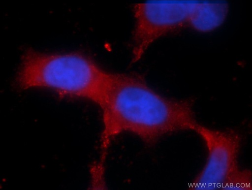 [55455-1-AP-150UL] TRPM6 Polyclonal antibody