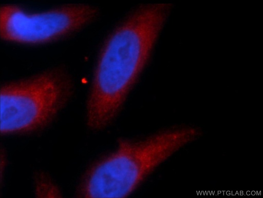 [55456-1-AP-150UL] TRIM63 Polyclonal antibody
