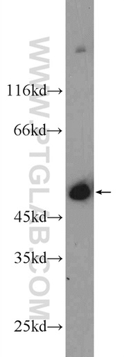 [55464-1-AP-20UL] MURC Polyclonal antibody