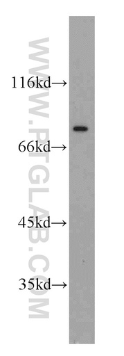 [55465-1-AP-20UL] NUP88 Polyclonal antibody