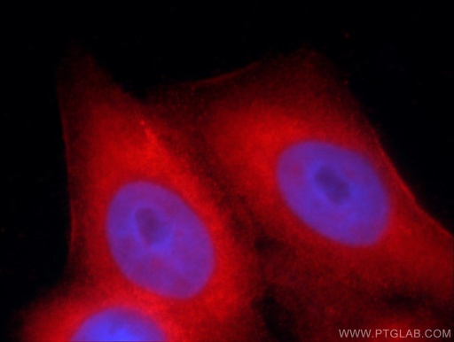 [55467-1-AP-20UL] MMP20 Polyclonal antibody