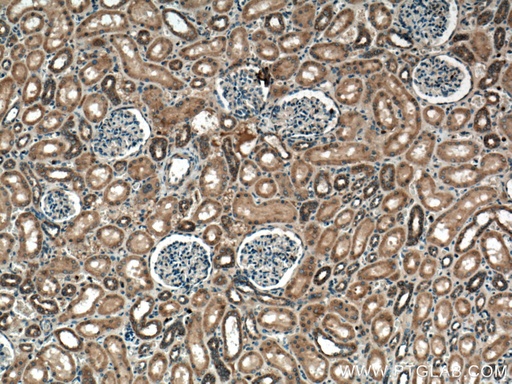 [55469-1-AP-150UL] RAB7A Polyclonal antibody