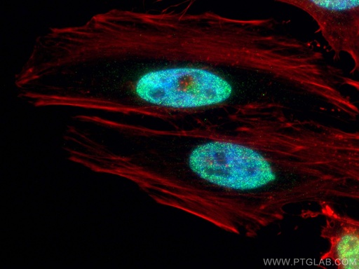 [55471-1-AP-150UL] ESR2 Beta 6 Polyclonal antibody