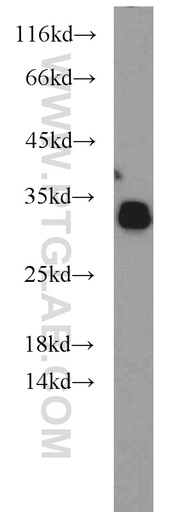 [55472-1-AP-150UL] NPAS3 Polyclonal antibody