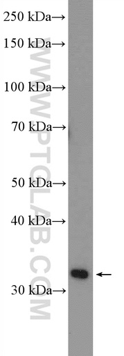 [55479-1-AP-150UL] LRRC38 Polyclonal antibody