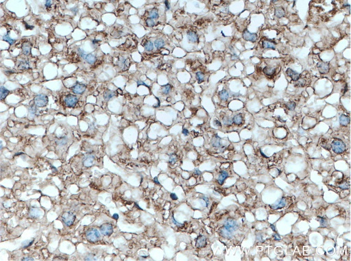 [55480-1-AP-150UL] Serpina3k Polyclonal antibody