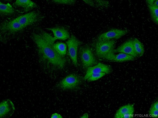 [55489-1-AP-150UL] MUC8 Polyclonal antibody