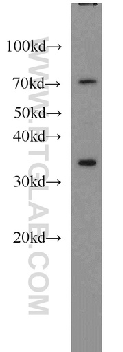 [55495-1-AP-20UL] HOXA11 Polyclonal antibody