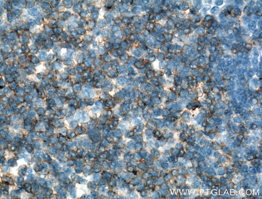 [60005-1-IG-150UL] CD2 Monoclonal antibody