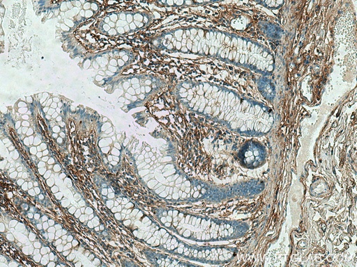 [60007-1-IG-20UL] TGFBI / BIGH3 Monoclonal antibody