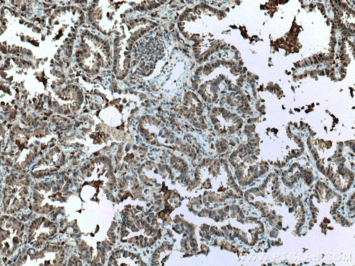 [60024-1-IG-150UL] S100A11 Monoclonal antibody