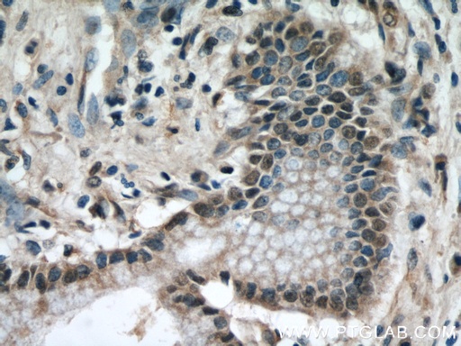 [60027-1-IG-20UL] KEAP1 Monoclonal antibody