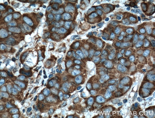 [60028-1-IG-20UL] DHCR24 Monoclonal antibody