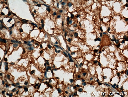 [60034-3-IG-20UL] MME,CD10 Monoclonal antibody