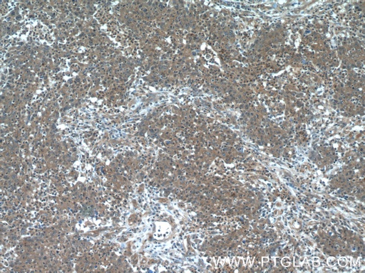 [60044-1-IG-20UL] Transgelin 2 Monoclonal antibody