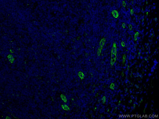 [60046-1-IG-150UL] ACKR2 Monoclonal antibody
