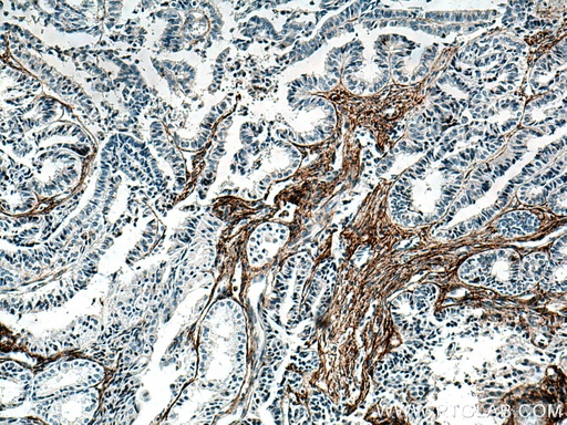 [60047-1-IG-20UL] EMILIN1 Monoclonal antibody