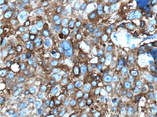 [60054-1-IG-150UL] MAGEA3 Monoclonal antibody