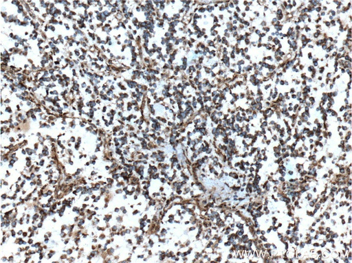 [60055-1-IG-20UL] MGP Monoclonal antibody
