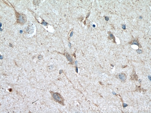 [60059-1-IG-150UL] Syntaxin 6 Monoclonal antibody