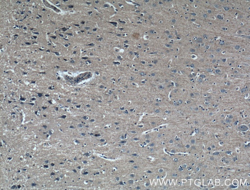 [60062-1-IG-150UL] GMF Beta Monoclonal antibody