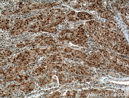 [60064-1-IG-150UL] HDGF Monoclonal antibody